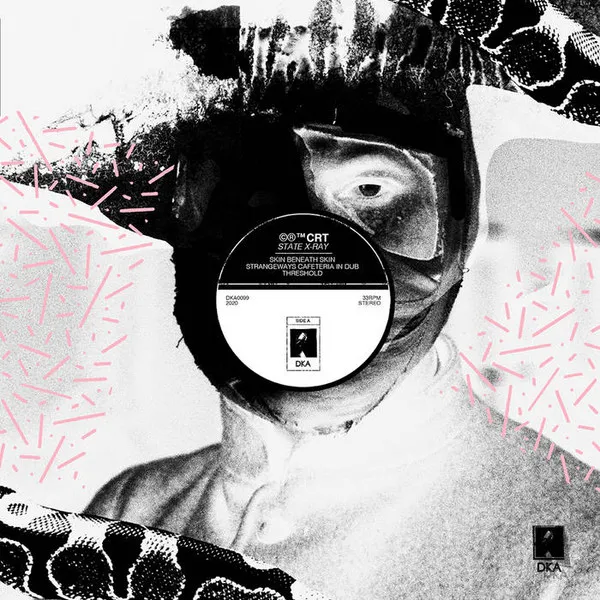State X-Ray