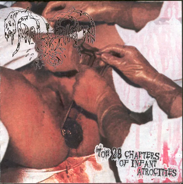 Top 28 Chapters Of Infant Atrocities