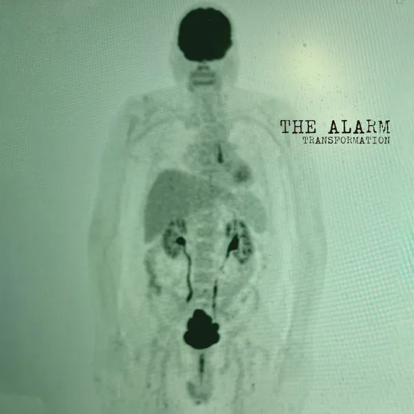 The Alarm