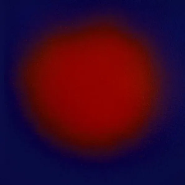 Vertigo
