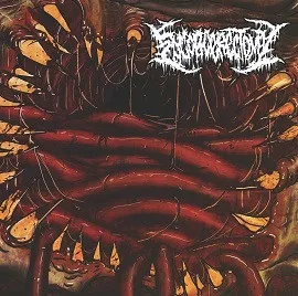 Engorgerectomy