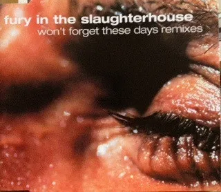 Won't Forget These Days Remixes