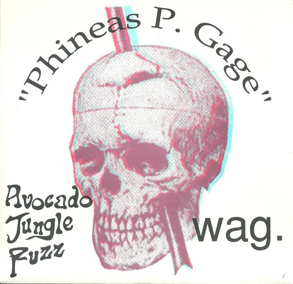 Phineas P. Gage
