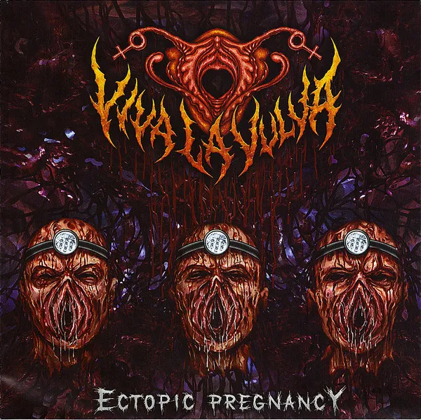 Ectopic Pregnancy