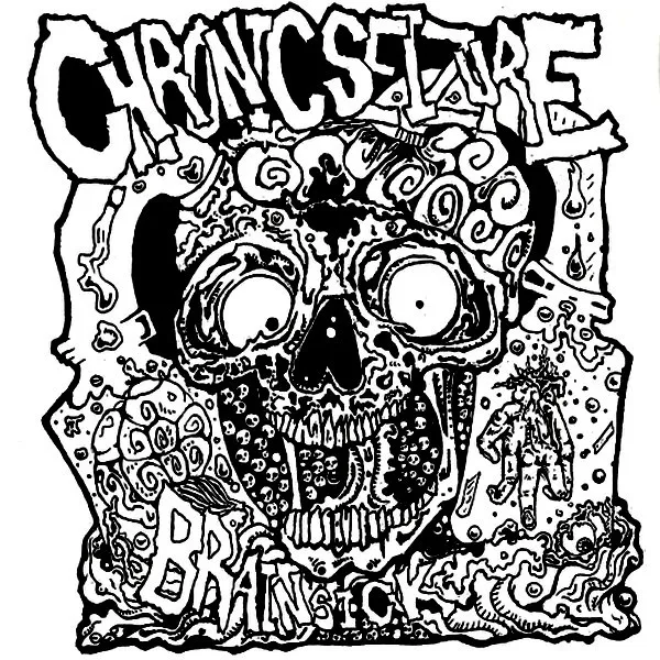 Chronic Seizure