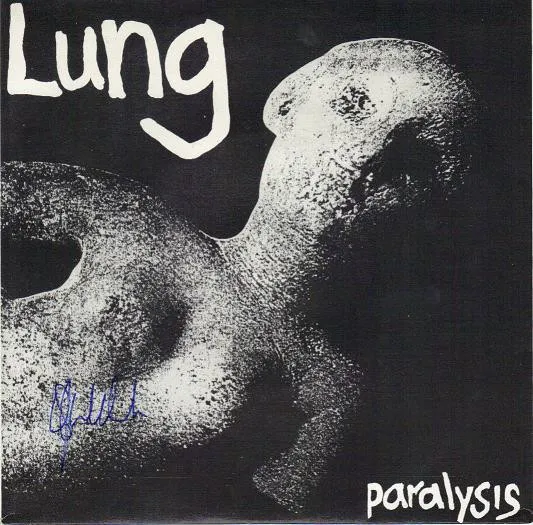 Paralysis