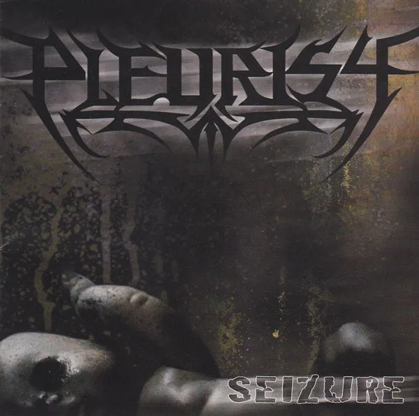 Seizure