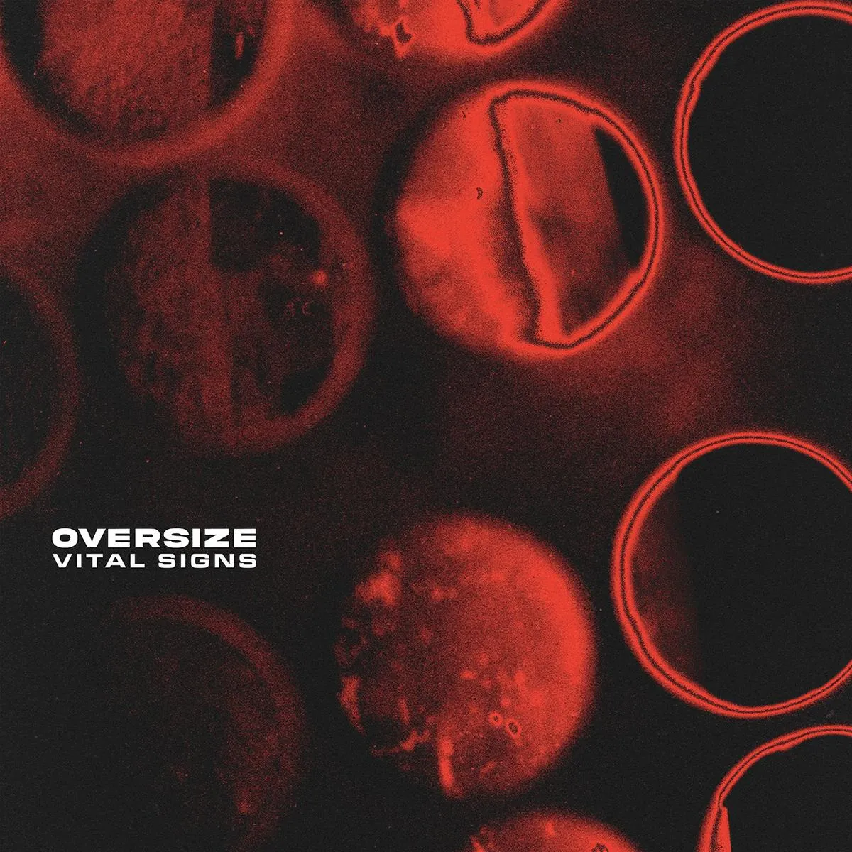 OVERSIZE