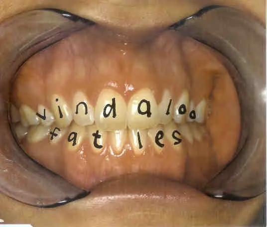 Vindaloo