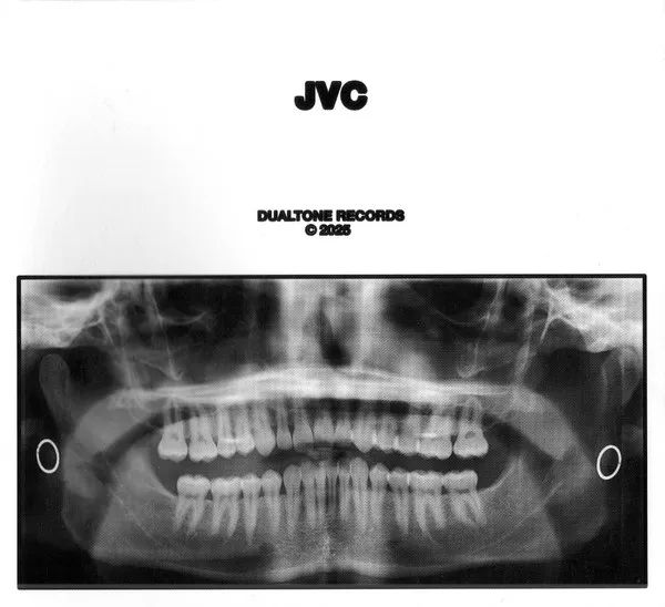 Jvc